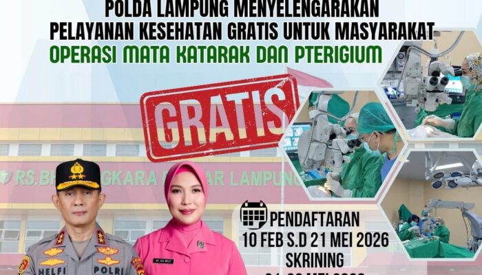 Polri untuk Masyarakat, Polda Lampung Gelar Operasi Katarak dan Pterigium Gratis Sambut Hari Bhayangkara ke-80
